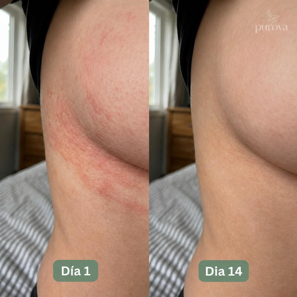 María, 52 años
