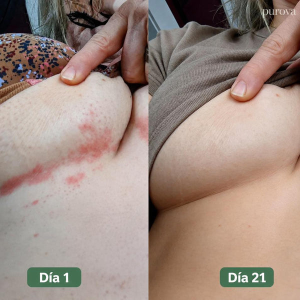 Isabel, 55 años