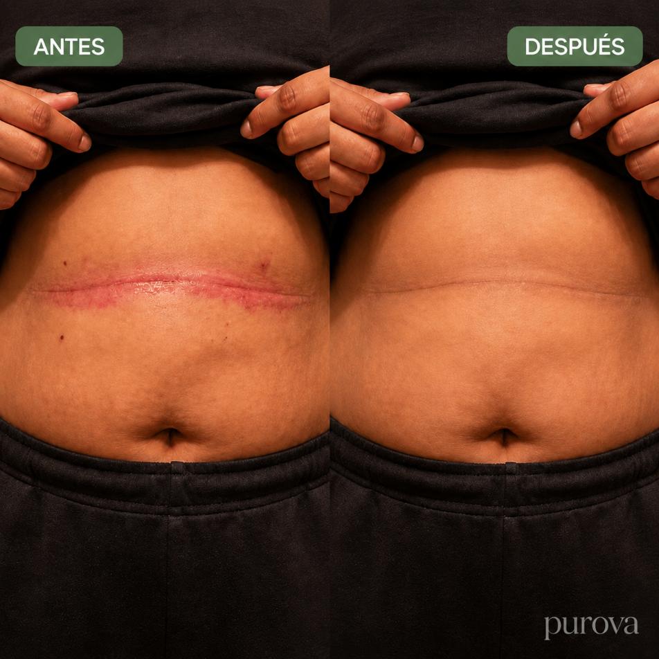 Crema para Pliegues™ | Alivia la irritación y el ardor en minutos