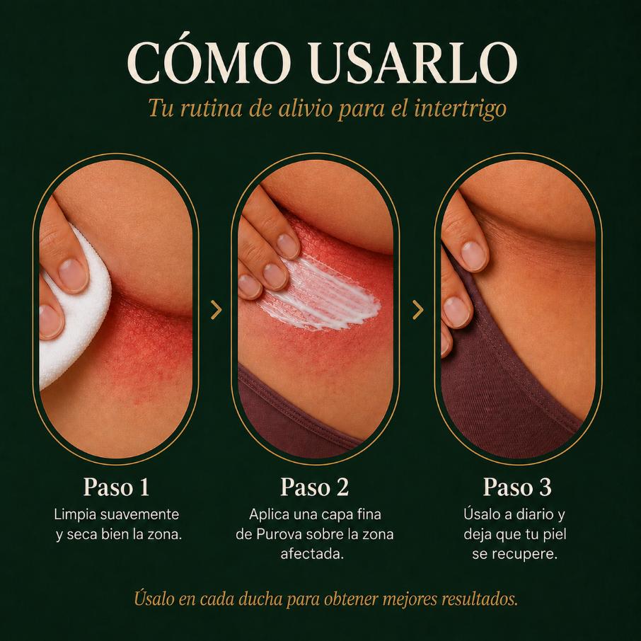 Crema para Pliegues™ | Alivia la irritación y el ardor en minutos