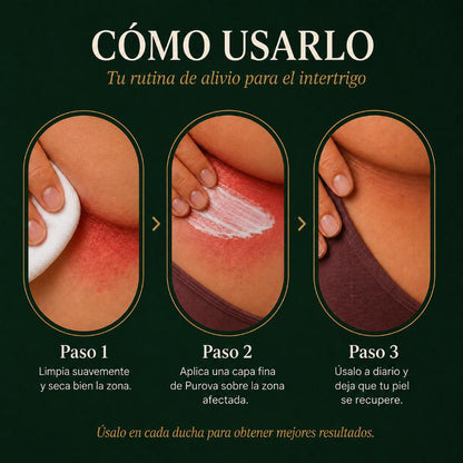 Crema para Pliegues™ | Alivia la irritación y el ardor en minutos